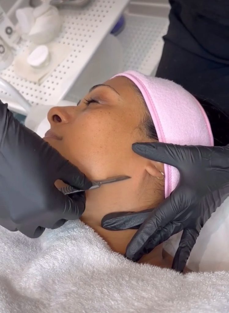 Clearer skin, smoother days: laser care in Iver