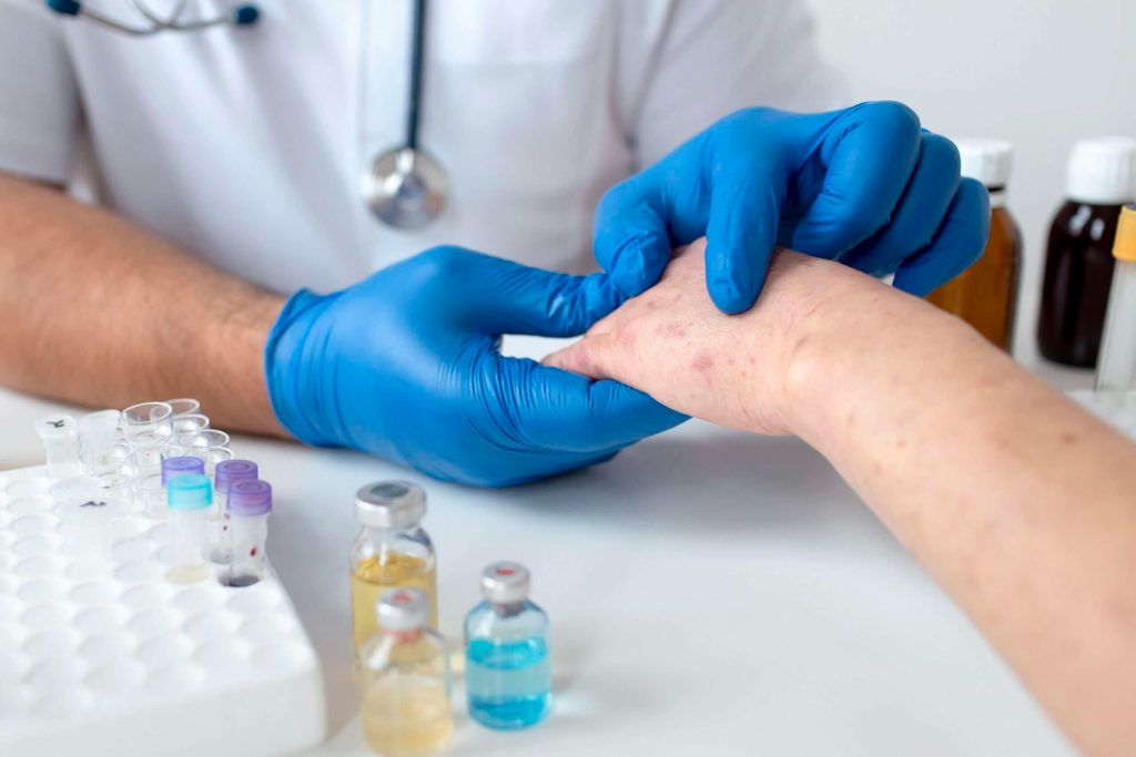 Find Reliable Toenail Fungus Care Nearby