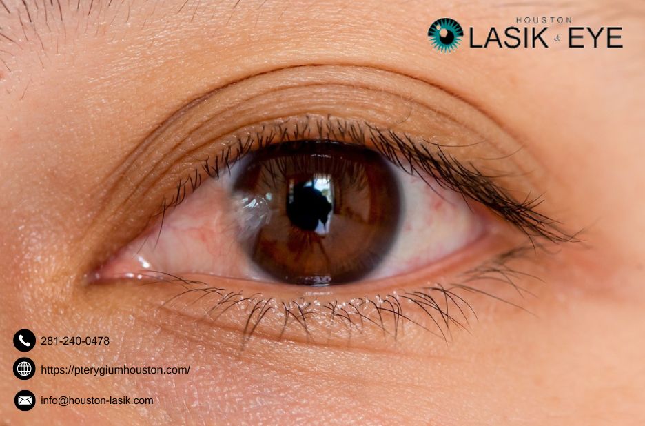 Practical Guide to Pterygium Removal and Eye Surgery Options Practical Guide to Pterygium Removal and Eye Surgery Options