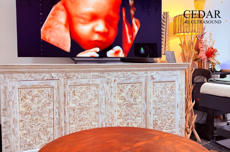 Witness the miracle: 3D baby imaging in Western Australia Witness the miracle: 3D baby imaging in Western Australia