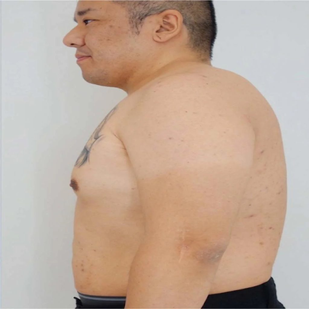 Realistic Duromine: What to Expect from Weight Loss Results