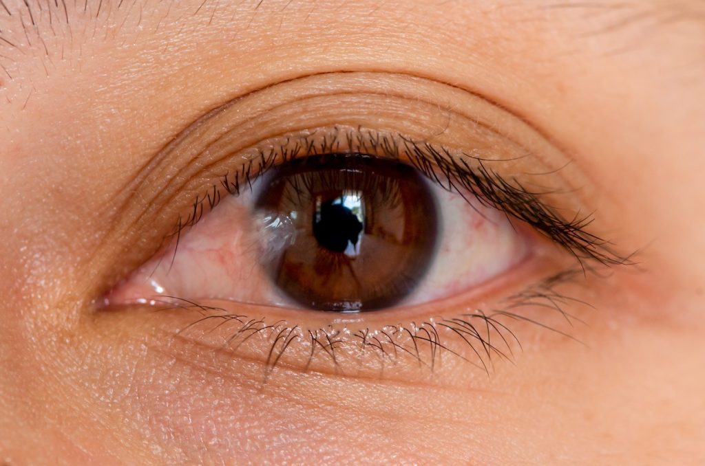 Pterygium: Treatment options and what to expect Pterygium: Treatment options and what to expect