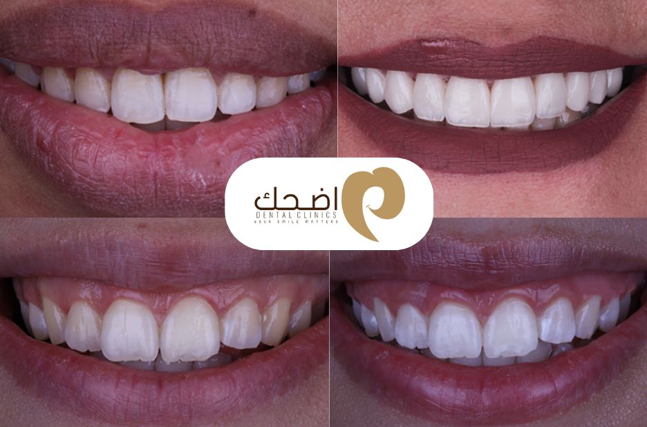 رعاية أسنان مميزة في قلب بنها وتقديم حلول آمنة رعاية أسنان مميزة في قلب بنها وتقديم حلول آمنة