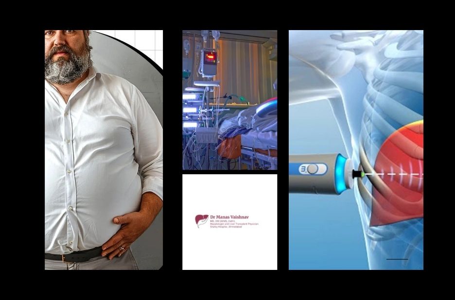 Top Best Liver Surgery Doctor in Gujarat for Expert Liver Care and Treatment Top Best Liver Surgery Doctor in Gujarat for Expert Liver Care and Treatment