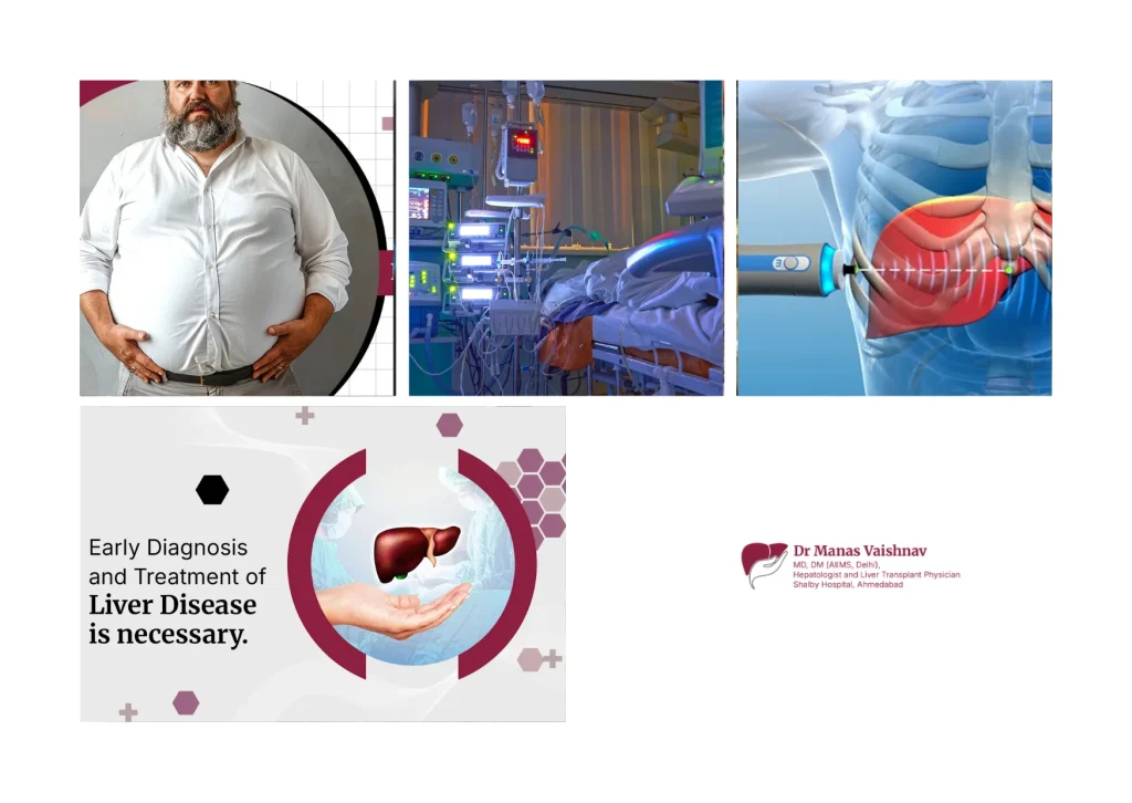 Comprehensive Liver Transplant in Gujarat Services for Expert Care and Support