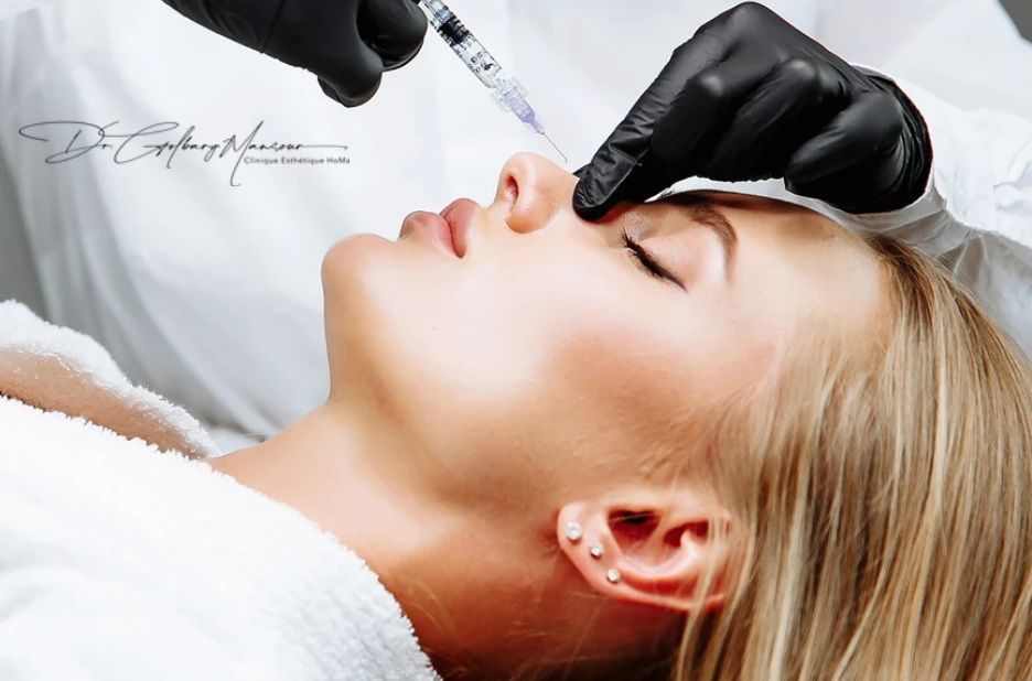 Expert Guide to Top Liquid Nose Reshaping Treatments in Montreal Expert Guide to Top Liquid Nose Reshaping Treatments in Montreal
