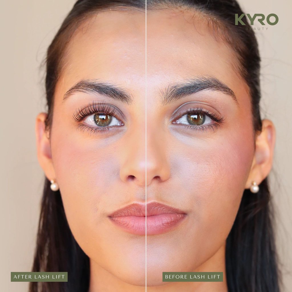 Discover Home Wimperlift Results with KYRO Beauty Discover Home Wimperlift Results with KYRO Beauty