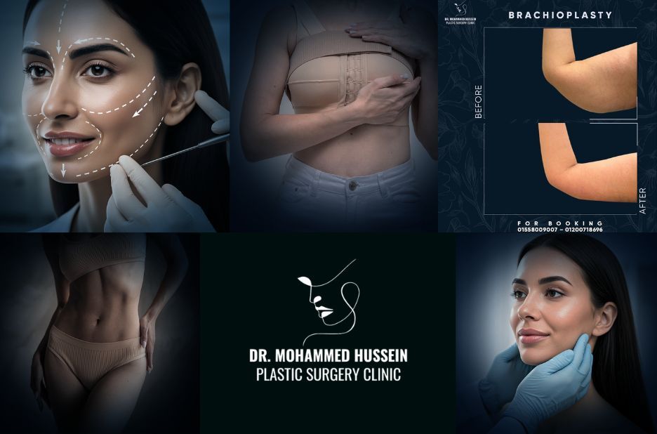 دليل شامل لجراحة التثدي للرجال في مصر مع طبيب مختص دليل شامل لجراحة التثدي للرجال في مصر مع طبيب مختص
